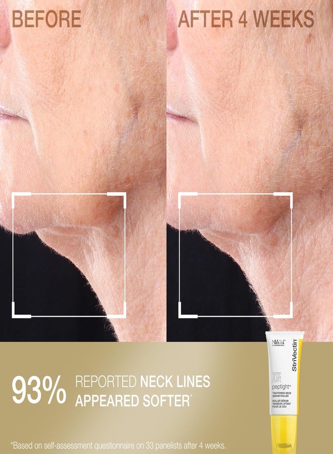 StriVectin Tighten & Smooth Neck Cream and Neck Serum Roller Anti-aging Skin Care 2-Piece Set, Smoothing Look of Wrinkles and Fine Lines, Improves Crepey Skin and Vertical Lines - Image 5